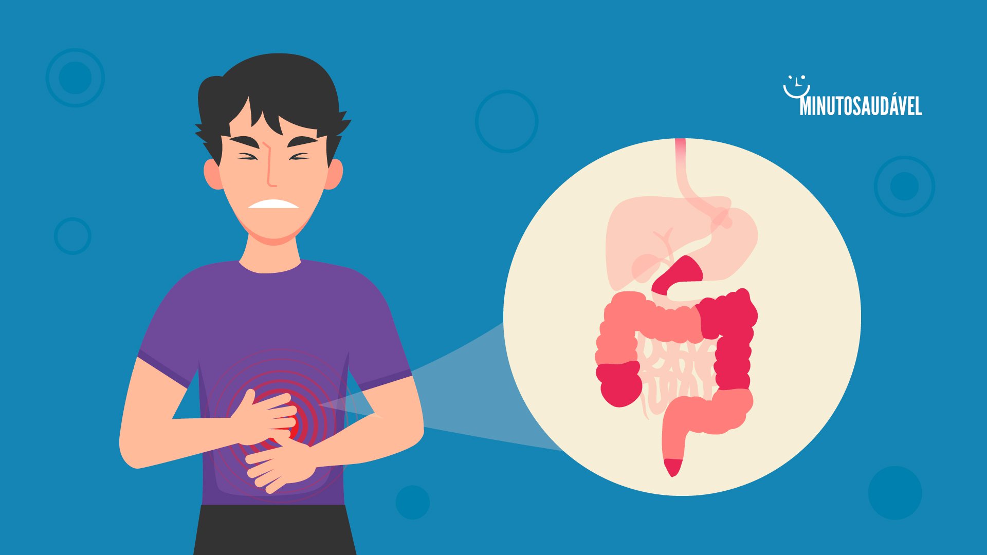 Foto de capa do artigo "Doença de Crohn: o que é, sintomas, alimentação, tem cura?"