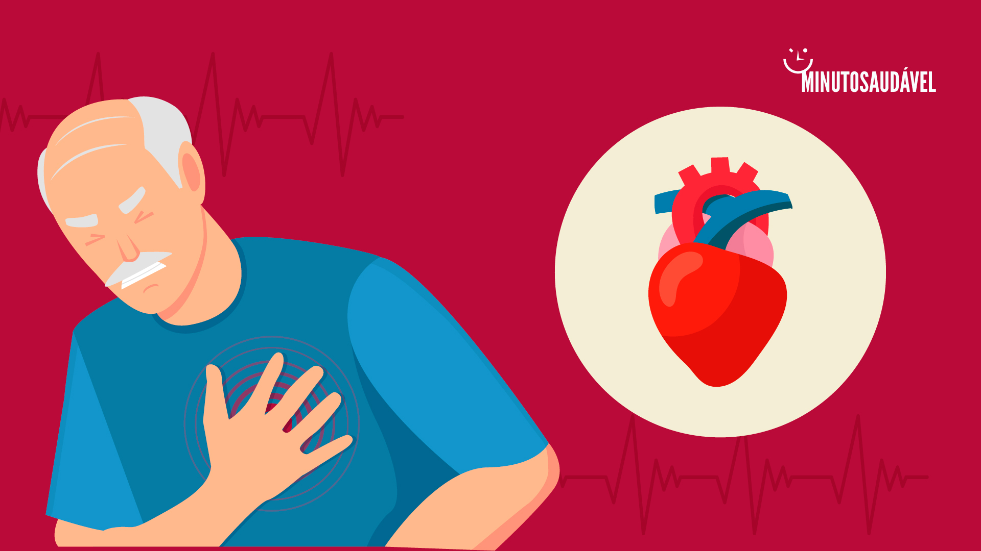 Foto de capa do artigo "Infarto (Ataque Cardíaco): veja causas, sintomas, tratamento"