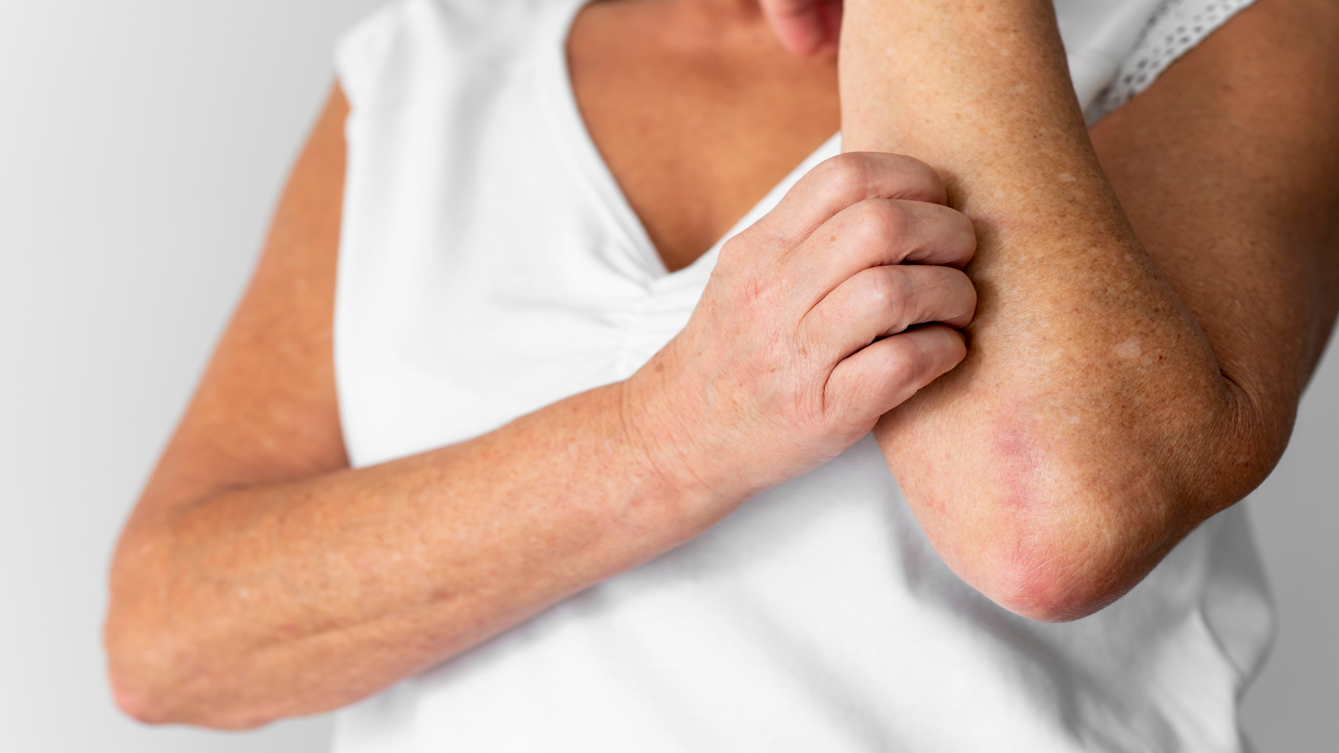 Foto de capa do artigo "Dermatite de Contato: tem cura? Veja o que é e como tratar"