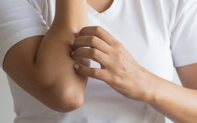 Foto de capa do artigo "Alergia na pele: causas e como identificar os sintomas"