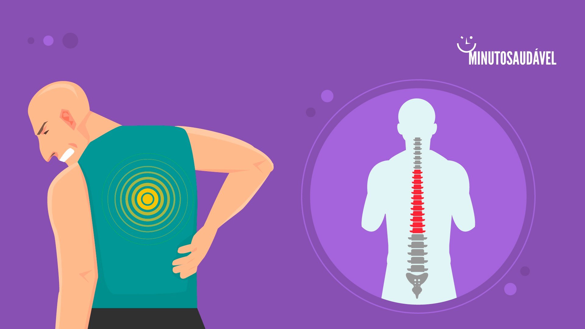 Foto de capa do artigo "Osteoporose na coluna: quais as causas e tratamentos? Tem cura?"