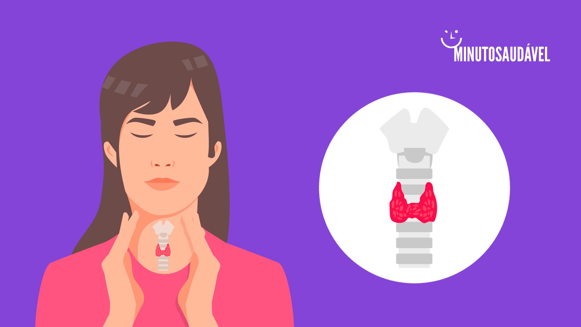 alimentos para tireoidite de hashimoto