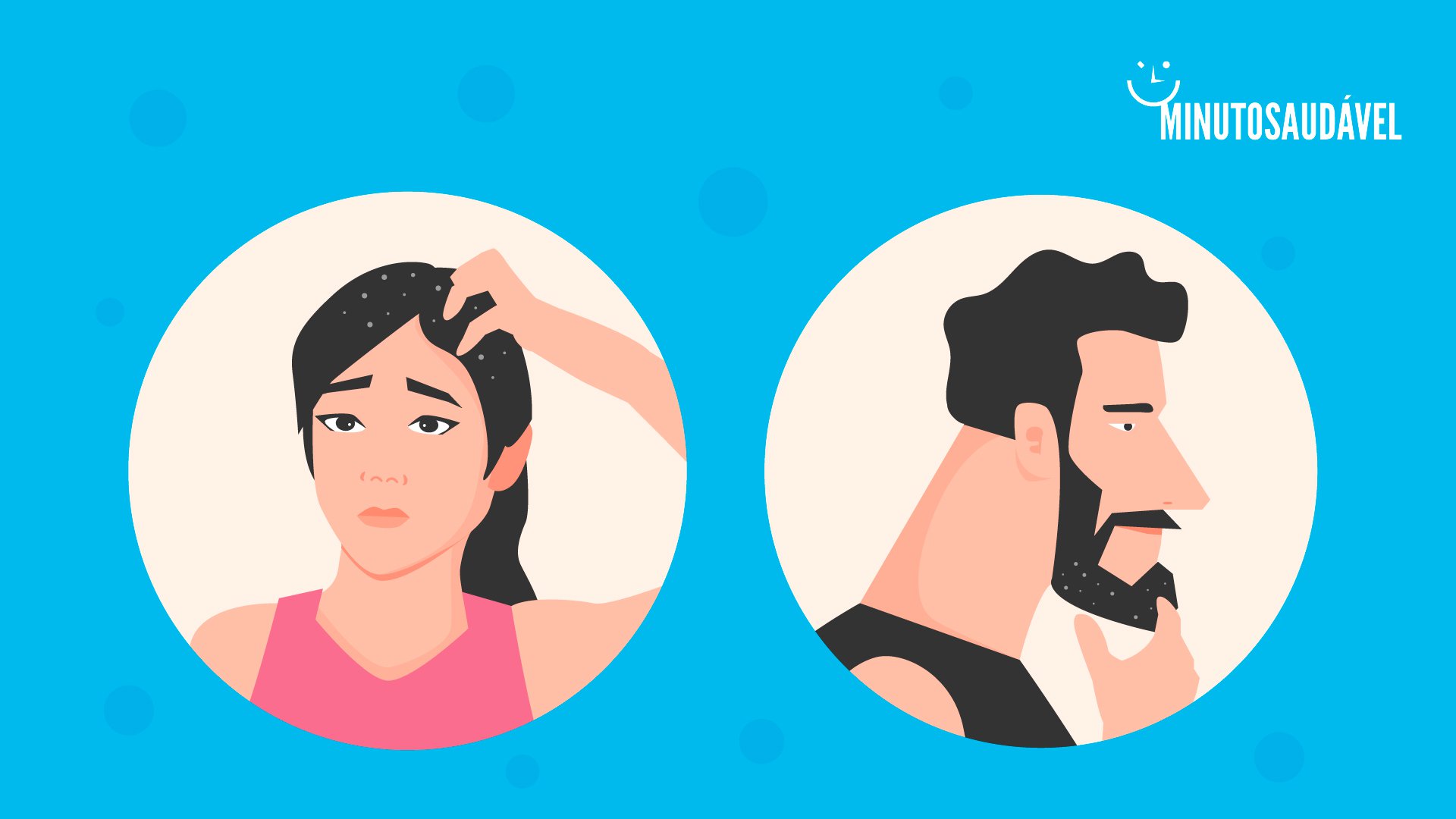 Foto de capa do artigo "Como acabar com a caspa: do cabelo cacheado à barba"