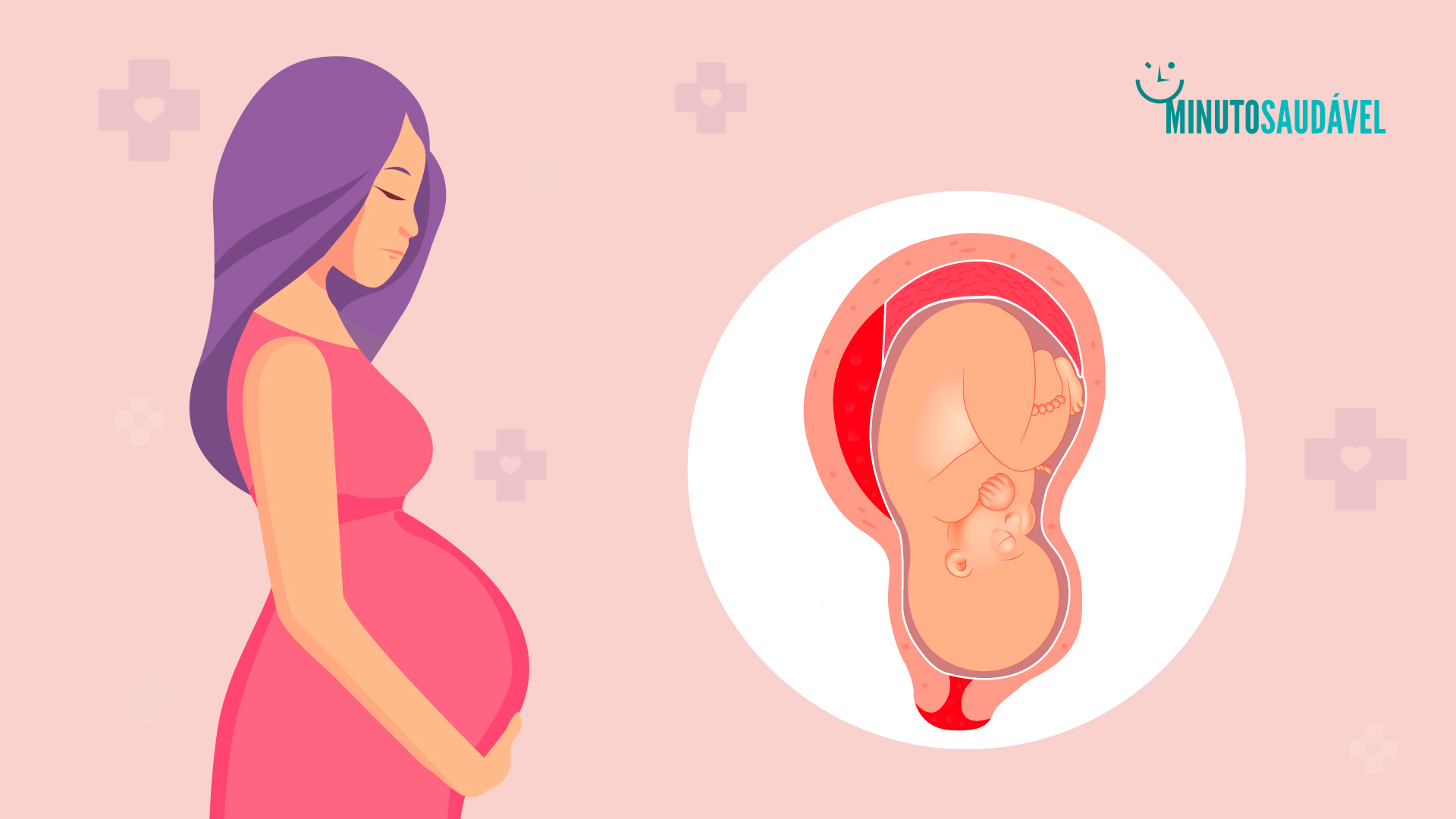 Foto de capa do artigo "Descolamento da placenta: é grave? Veja quais os sintomas"
