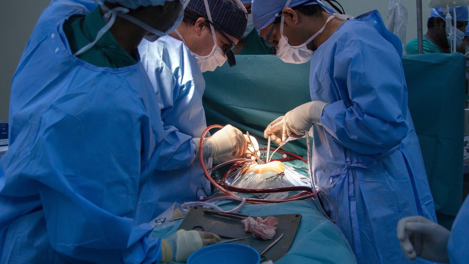 Equipe médica realizando uma cirugia bariátrica na sala de operações.