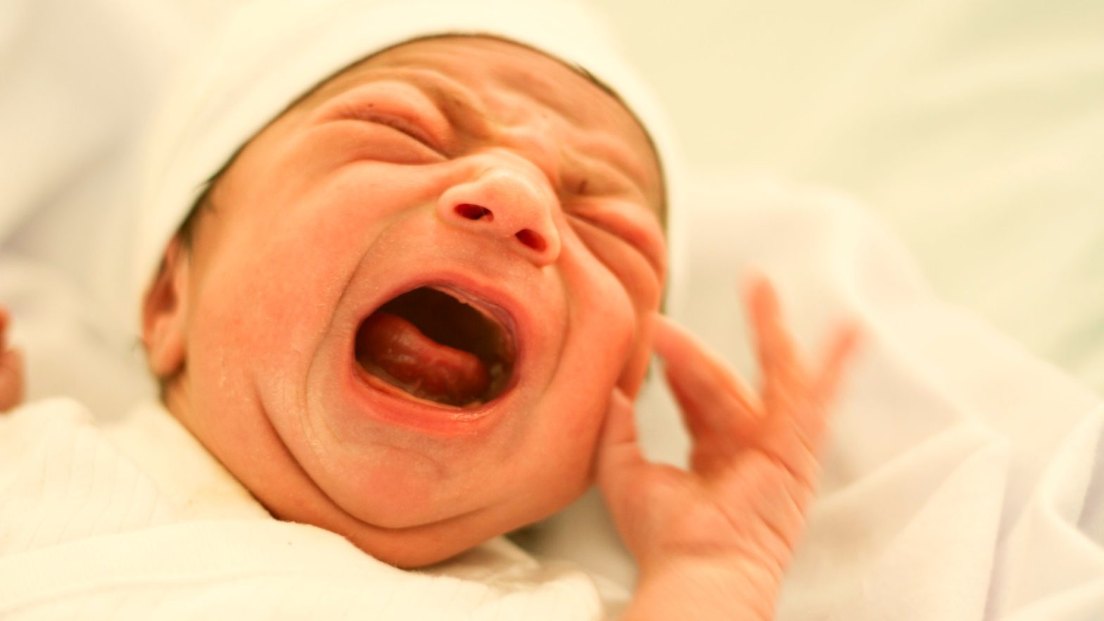 Recém-nascido com ictericia neonatal chorando.