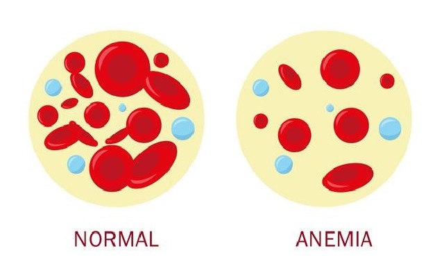 Ilustração de duas células, uma contém mais glóbulos vermelhos e a outra não, caracterizando a falta de consumo de alimentos ricos em ferro. 