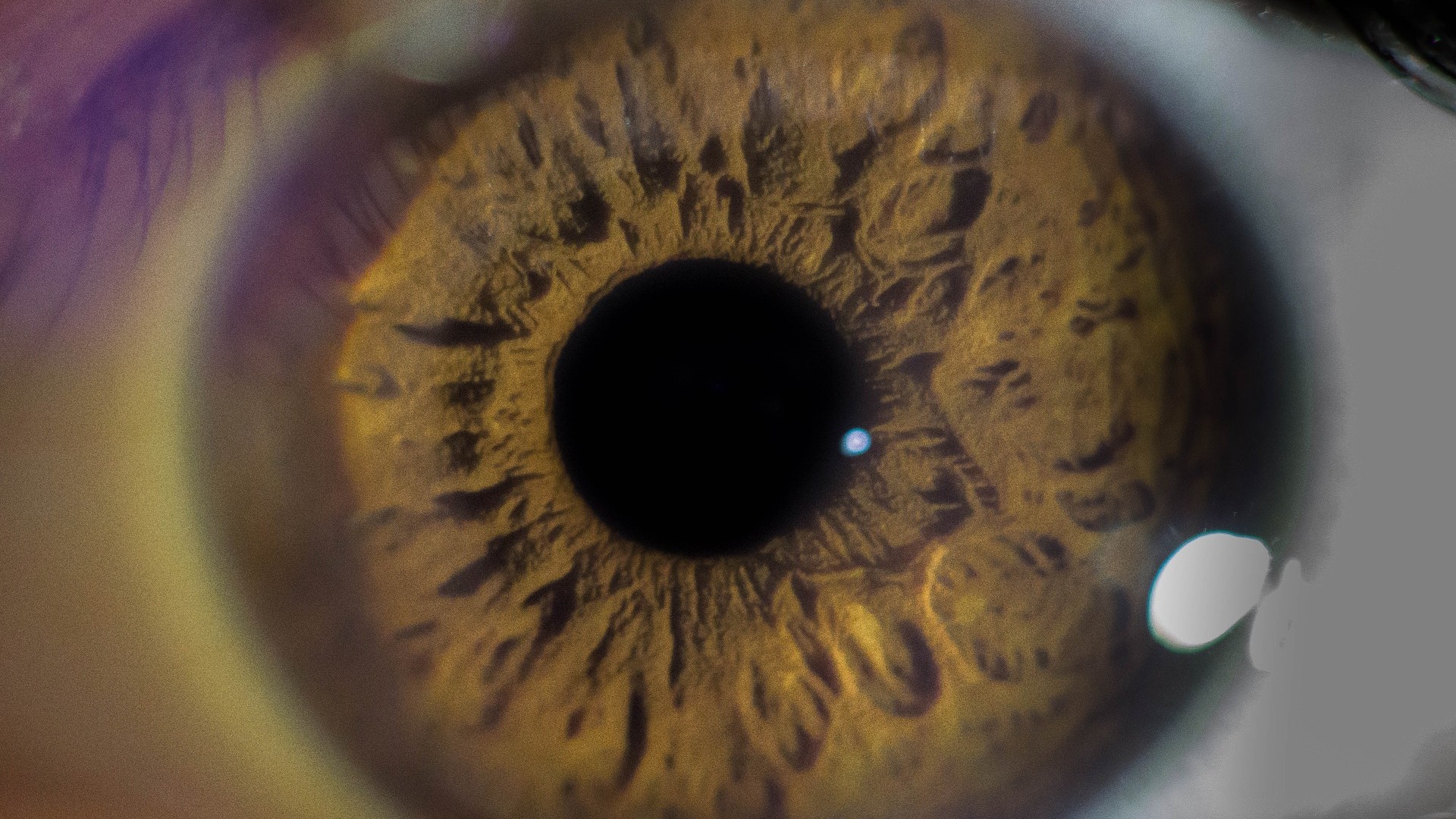 Foto de capa do artigo "Glaucoma: tem cura? Quais são os colírios utilizados?"