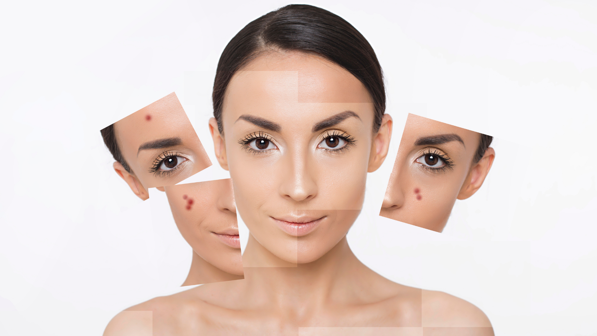 Foto de capa do artigo "Ácidos para a pele: quais os tipos, benefícios e indicações?"