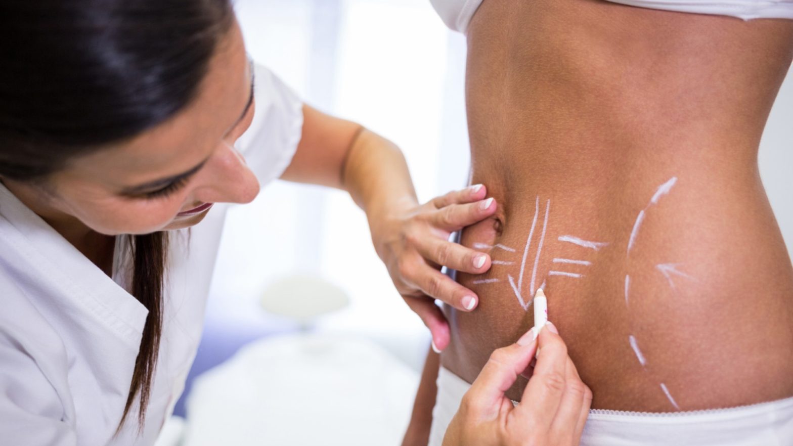 Cirurgiã avaliando abdômen de paciente para fazer a lipo lad.