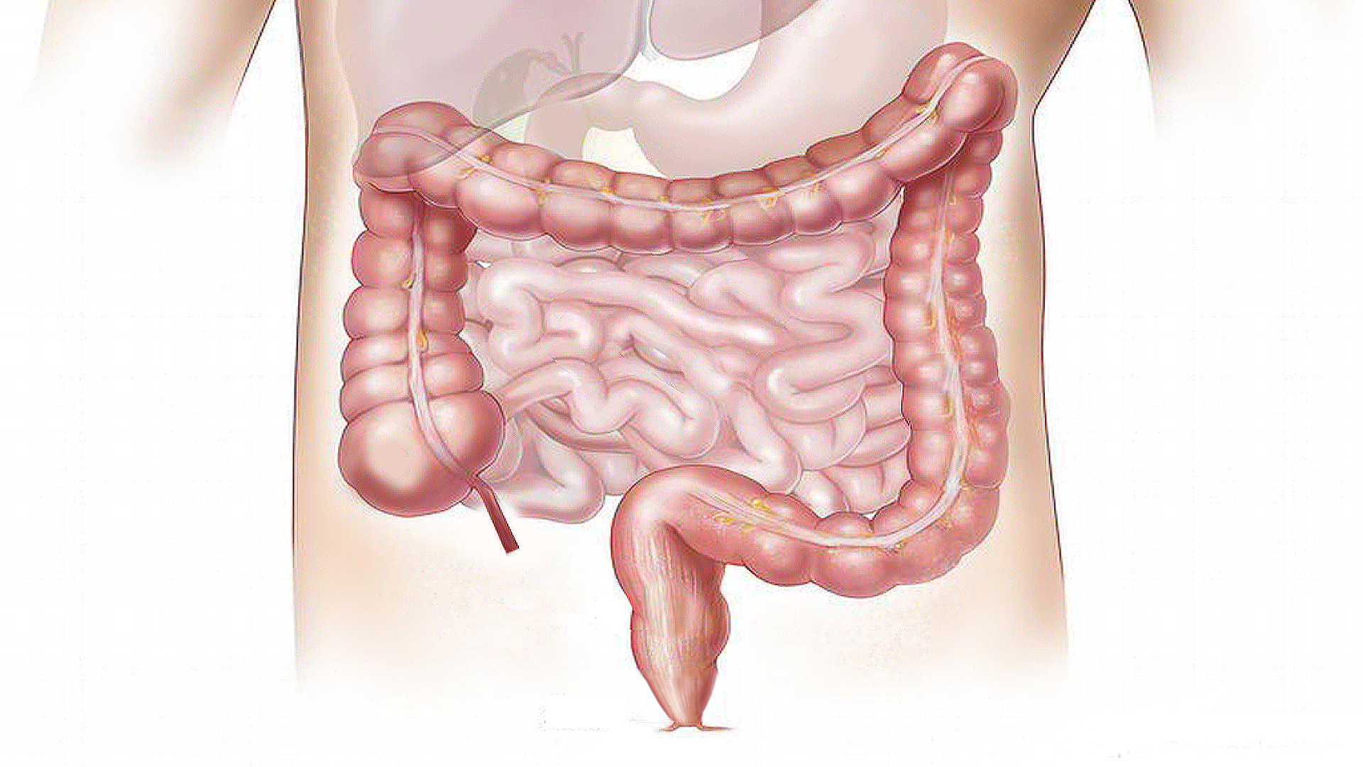 Foto de capa do artigo "Síndrome do Intestino Permeável: o que é, causas e sintomas"